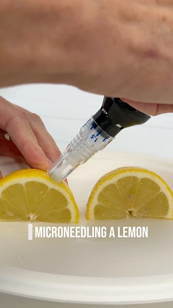 Microneedling explained 🍋 See how microchannels support collagen + treatment enhancements.