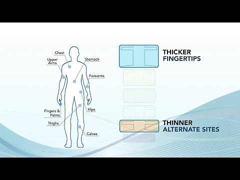 Selecting the Optimum Contact Tip for Lancing