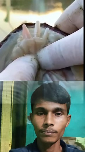 21K views · 62 reactions | Botfly removal and health care | Jabed Hossen | Facebook