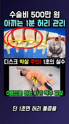 수술비 500만 원 아끼는 1분 허리 관리
