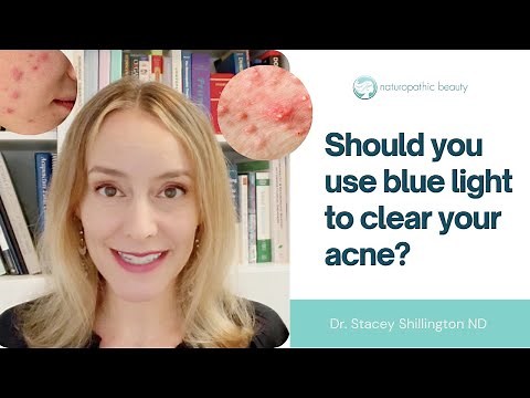 Blue LED light therapy for acne