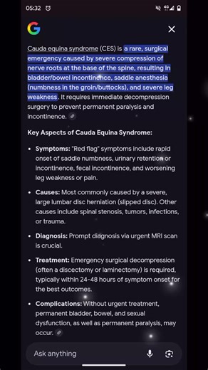 Emergency Surgery for Cauda Equina Syndrome