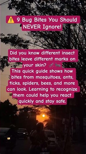 ⚠️ 9 Bug Bites You Should NEVER Ignore! Ant Tick Bed Bug Scorpion Bee Flea Spider Wasp Mosquito