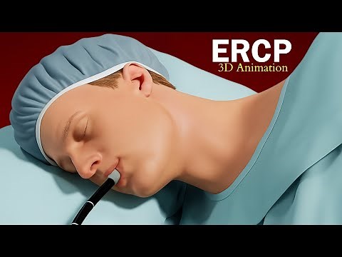 ERCP Procedure : 3D Animation | The Scopic Vision