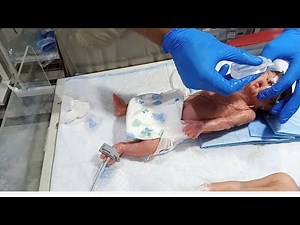 22 Weeks Preterm Baby in NICU | Daily Routine Care, Monitoring & Progress Update | LBW Baby Journey”