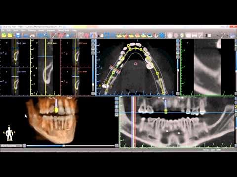 Blue Sky Plan 3 Tutorial: Mouse Functionality
