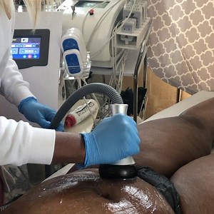 9 comments | Lymphatic drainage helps to release dissolved fat toxins. How is dissolved fat released from the body? Fat is expelled through stool, urine and sweat! Water consumption is of utmost importance for good results. Want to try it? Specials as low as $50. Click the link to schedule your consultation today. #fatloss #bodygoals #weightloss #summerbody #vacation #summer #houston #montrosehouston #bodyspa | SkinTite Body Sculpting Spa | Facebook