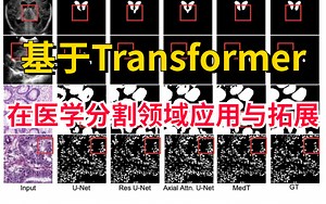 【神经网络-医学应用】计算机博士全面解析Transformer在医学分割领域应用与拓展，附带超详细的MedicalTransformer源码解读！