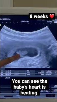 Ultrasound 8 weeks pregnant. The Baby’s heart is beating