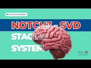 NOTCH3-SVD Staging: New System for CADASIL & Small Vessel Disease