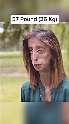 The Skinniest People In The World 🤯