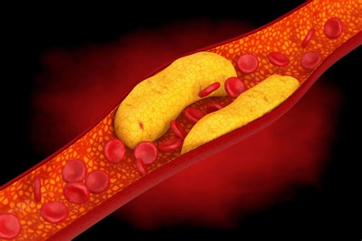 What you should know about cholesterol and how it impacts your health