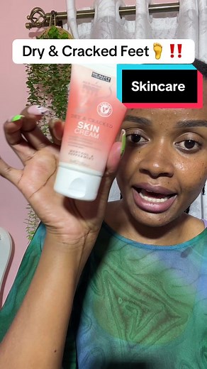Effective Acne Treatment Strategies for Clear Skin