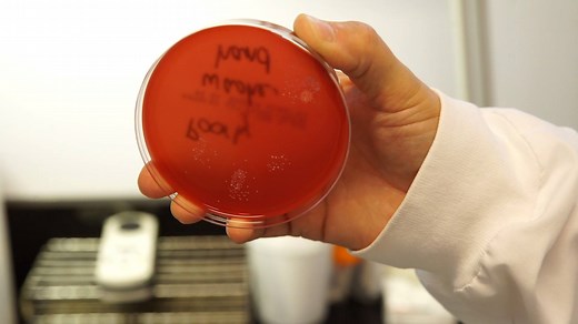 You've gotta see this! Think you're washing your hands thoroughly? Think again. This experiment shows just how much bacteria remains on our hands after a typical handwashing, compared to a proper handwashing. More cool experiments: https://www.hamiltonhealthsciences.ca/share/proper-hand-washing/ | Hamilton Health Sciences