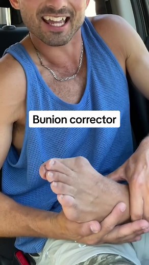 Transformative Bunion Correction: My Toe Journey