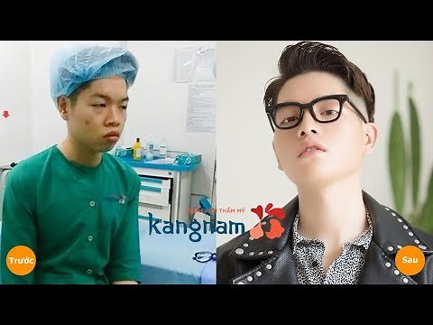 Duc Phuc before plastic surgery