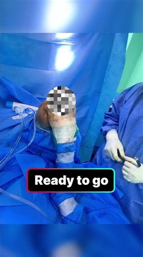 Knee Replacement Surgery – Step by Step 🦵✨