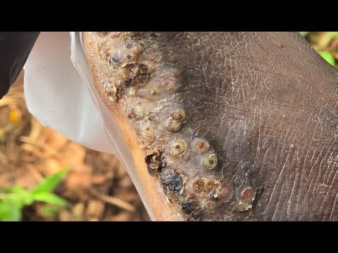 Jackton Liayuka's first jigger digging #1 - see long vids @ riseupsociety.net & ruskenya.org