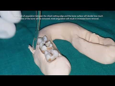 preclinical oral surgery: the use of chisel and mallet part 2