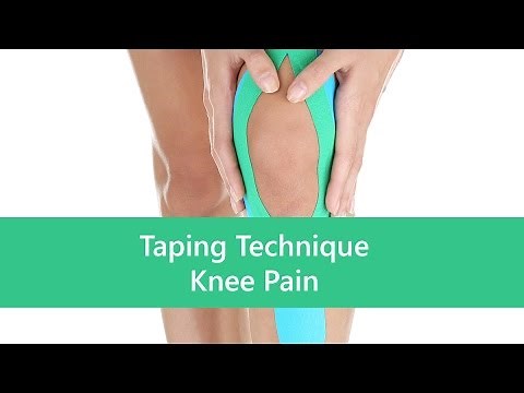Taping Technique for Anterior Knee Pain