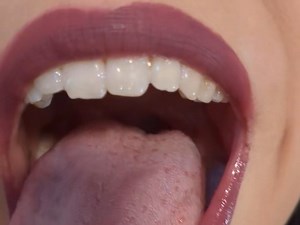 口腔检查系列1-口试 15 | #oralexam #openmouth #口腔检查