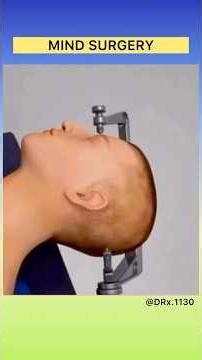 How do doctors open the skull without damaging the brain? 🧠 Watch the incredible science 😱