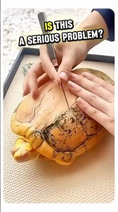 This Turtle’s Shell Is Peeling... And It’s Surprisingly Satisfying!