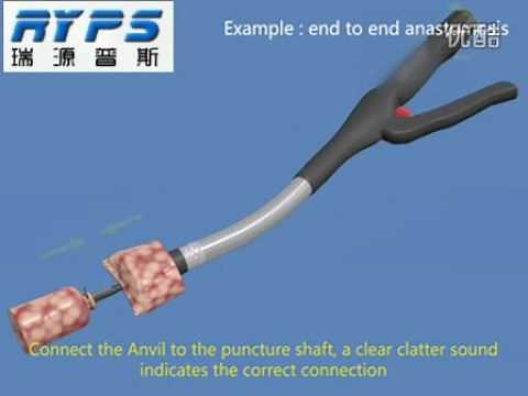 Intraluminal Circular Stapler for Surgery