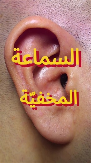 You asked. We answered. The IIC hearing aid sits deep in the ear canal, completely out of sight and is easily removed using a discreet removal cord. Small in size, big in performance. نُجيبكم عن سُؤالكم. تجلس سماعة IIC بعمق داخل الأذن لتكون غير مرئية تمامًا، ويتم سحبها بسهولة باستخدام خيط سحب مخفي. صغيرة في الحجم، كبيرة في الأداء. #hearingaids #iic #audiology