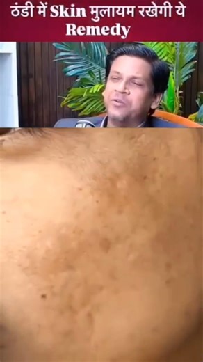 sardiyon mein aapka skin raf aur dry ho jata hai to is remedy Ko jaror try kare #homemadecream #yt