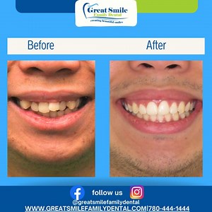 Before and After: Our Recently Completed Ortho Patient! 殺 See the...