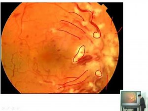 Dossier PAE - Ophtalmologie 01