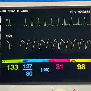 🏔️🏔️🏔️Case Study Friday🏔️🏔️🏔️ Dispatched to a possible shooting and cleared in after scene is determined secured. 30 year old male laying on the ground handcuffed with blood squirting out of his mouth. Police officer reports he was running down the road at them was tased and taken the the ground in the grass. He is handcuffed and taser darts are still in his back. Patient is able to speak in short sentences with a profouse amount of blood squirting from his mouth. Another EMS personnel is 