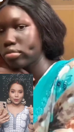 Viral water cap dimple hack 😲🤯😱 #Viral #hack #dimple #reelvideo | Anisha Das