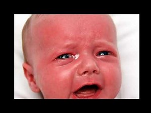 Case 652 infant dyschezia, grunting baby syndrome, crying baby, infantile colic, constipation