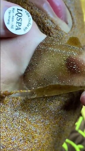 Whitehead + Blackhead Deep Cleaning | Skincare Treatment&Facial