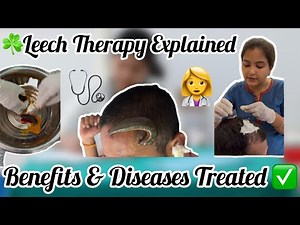 How Leech Therapy Works: Uses, Advantages & Safety Precautions | BAMS | Dr Prerna |👩‍⚕️🩺✅