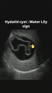 159K views · 2.7K reactions | Chest Pathology | Radiology Department | Facebook