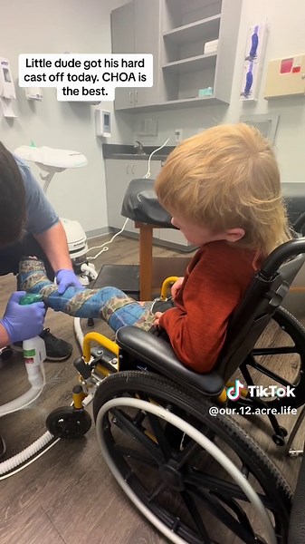 Luca dgot his hard cast off today! Now just a brace for the new two months. #cast #choa #childrenshealthcareofatlanta #brokenleg #castremoval