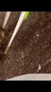 Pelos encravados 😱