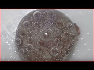 Wound scab under hidrogen peroxyde.