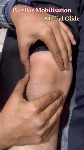 ✨Patellar mobilization#physiotherapy #kneepain #mobilization #shorts