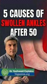Why Ankles Swell After 50 — 5 Causes Explained | Dr. Yashwant Explains #shorts #doctor #swollenfeet