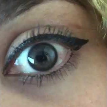 Morning after initial laser session - eye color change iRex Laser