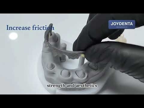 Missing multiple teeth but can’t use implants or bridges?