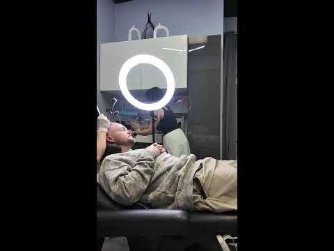 SMP Progress – 3rd Session LIVE | Scalp Micro Pro Clinic