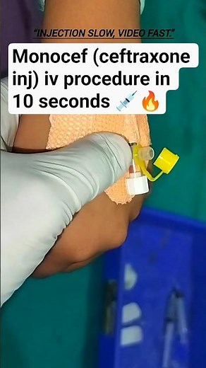 Ceftriaxone IV Injection Through Cannula | Complete Step-by-Step Procedure 💉 #shorts #nursingskills