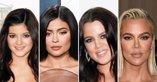 Kardashian-Jenners Plastic Surgery: Before and After Photos