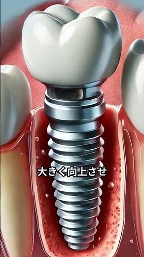 A Savior for Implant Treatment! Explaining the Effects, Costs, and Risks of GBR (Bone Regeneratio...