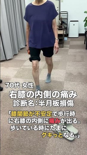 【70代半月板損傷】半月板損傷と診断された膝の痛みが最後の砦で手術なしで改善！